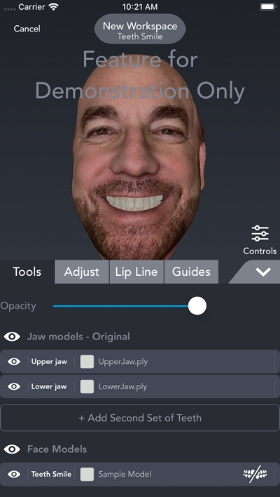 Bellus3D Dental Pro3