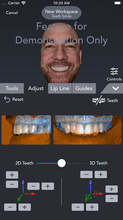 Bellus3D Dental Pro4
