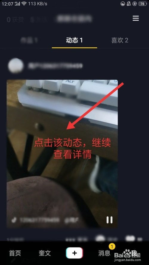 抖音评论回复为何消失